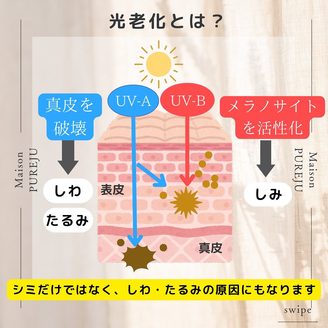シミだけじゃない！紫外線が引き起こすシワ・たるみと光老化の正体 画像3