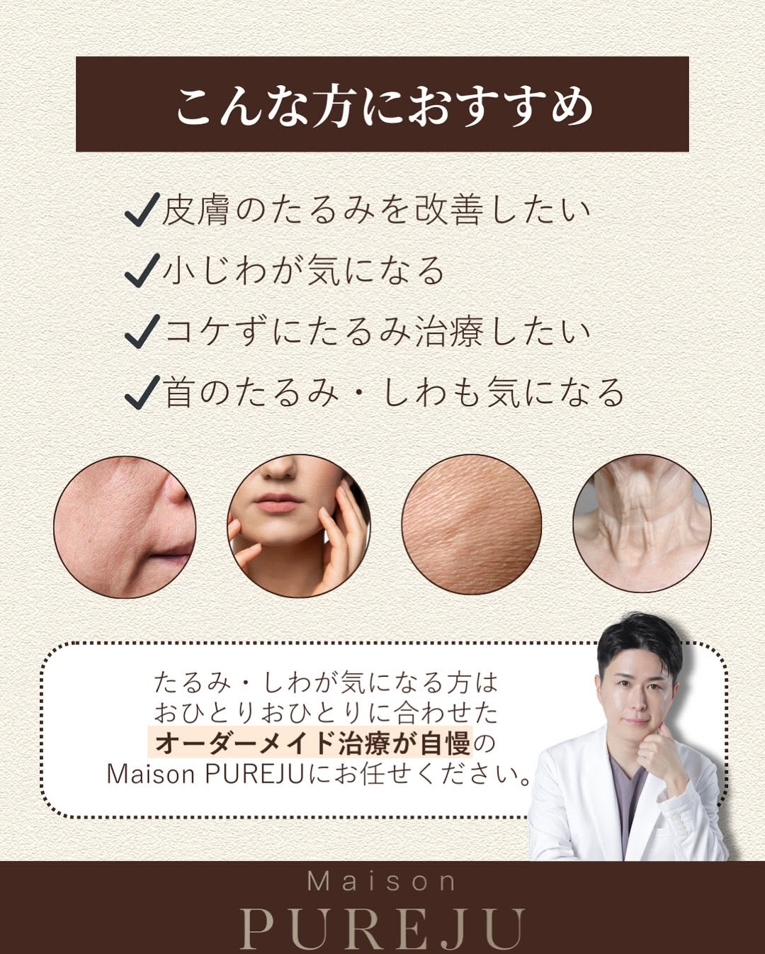 ソフウェーブで目周りの小じわをアイロンのようにピンと伸ばした症例 画像4