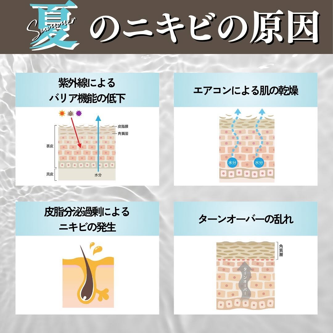 夏のニキビの原因と治療法｜紫外線・エアコン乾燥・皮脂過剰・ターンオーバー乱れへの4つのアプローチ 画像2