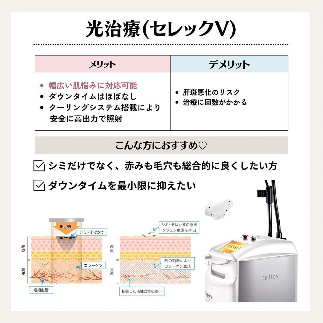 シミ治療の選び方｜ルビーフラクショナルとIPL（セレックV）の違いを徹底比較 画像4