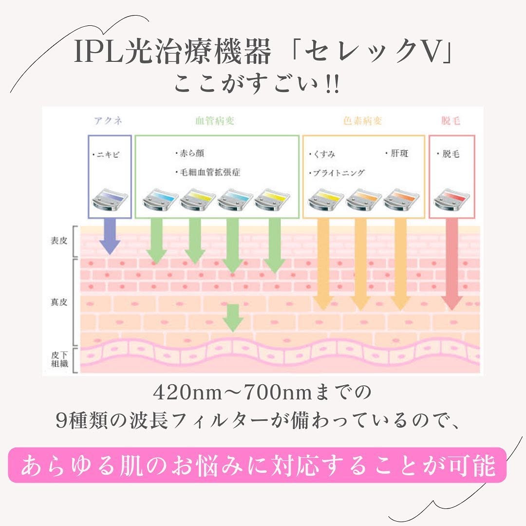 セレックVとは｜IPL光治療機器の9波長フィルターでシミ・赤み・ニキビを一台で改善 画像2