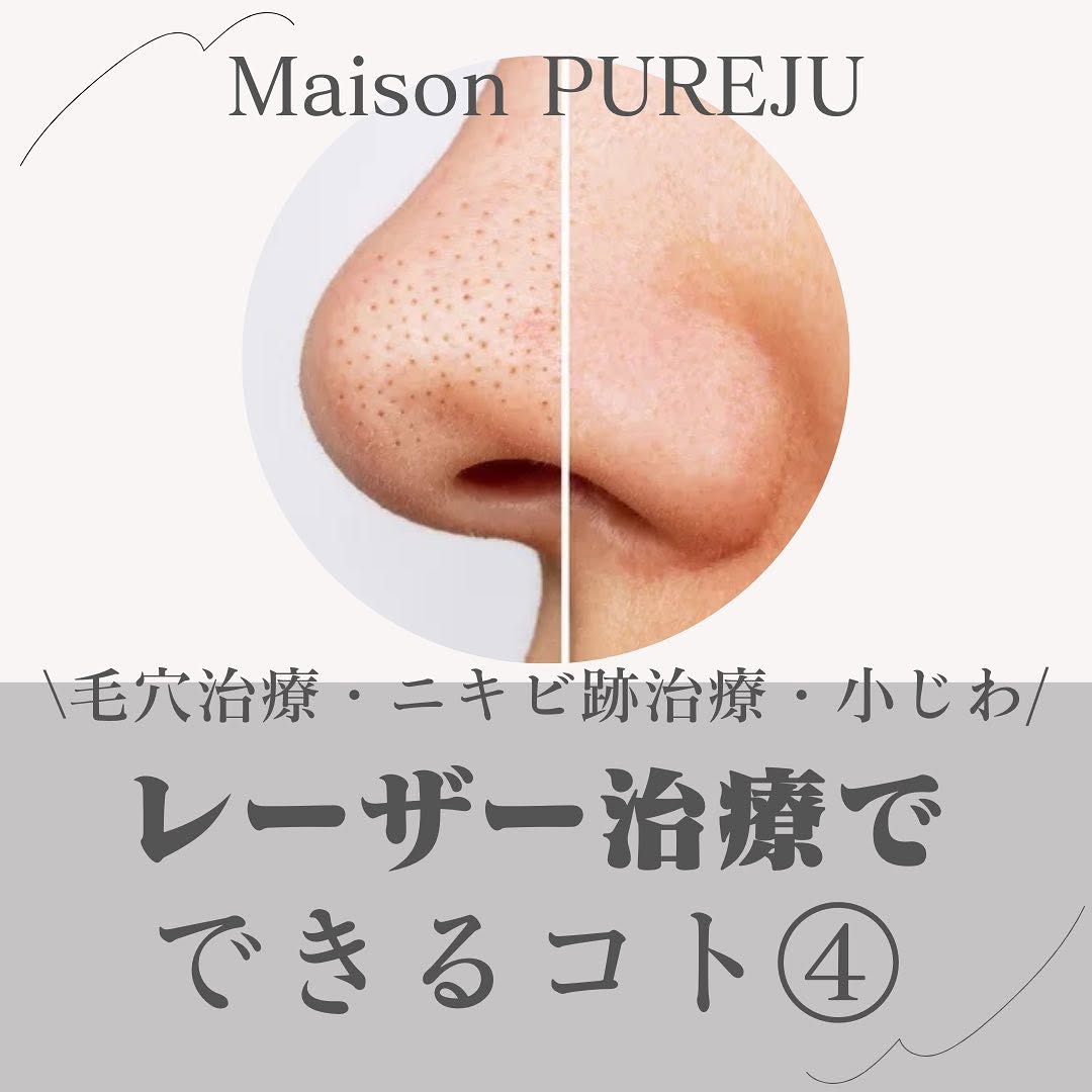 1064フラクショナルとは｜衝撃波で毛穴・ニキビ跡・小じわをコラーゲン再生で改善