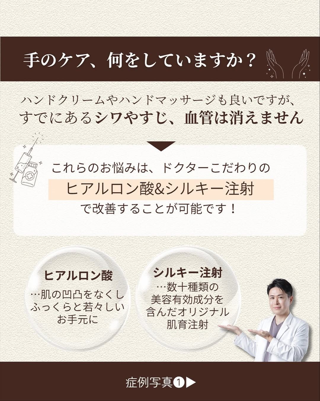お手元の若返り術2選｜ヒアルロン酸・シルキー注射で手のシワ・すじ・血管をケアする方法