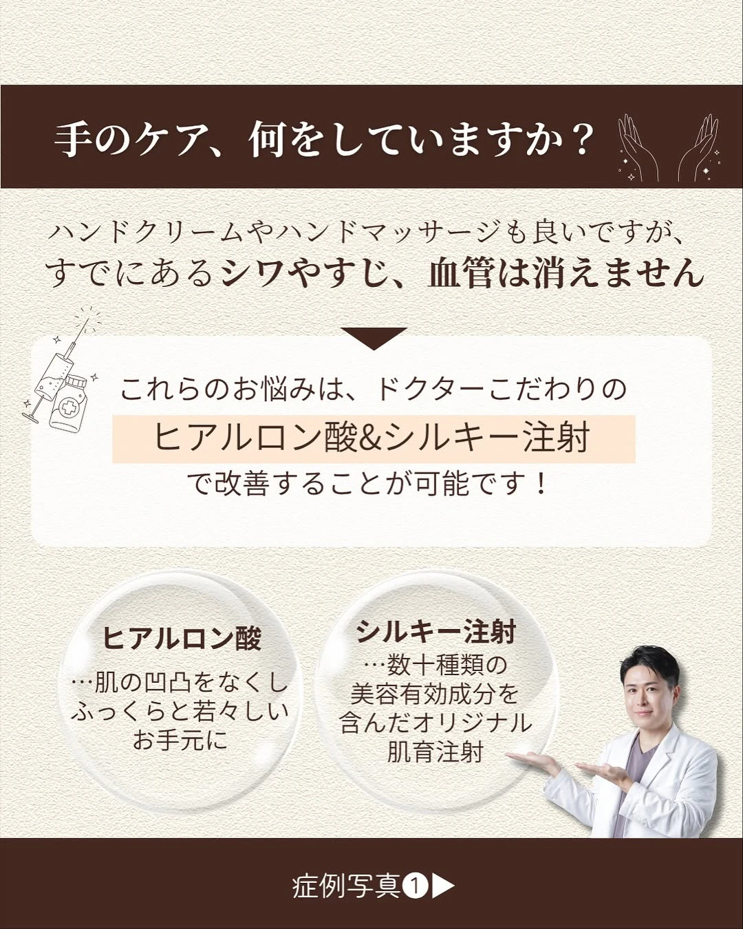 お手元の若返り術2選|ヒアルロン酸・シルキー注射で手のシワ・すじ・血管をケアする方法