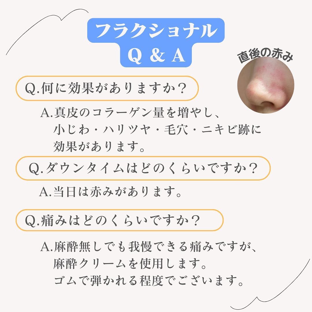 1064フラクショナルとは｜衝撃波で毛穴・ニキビ跡・小じわをコラーゲン再生で改善 画像3
