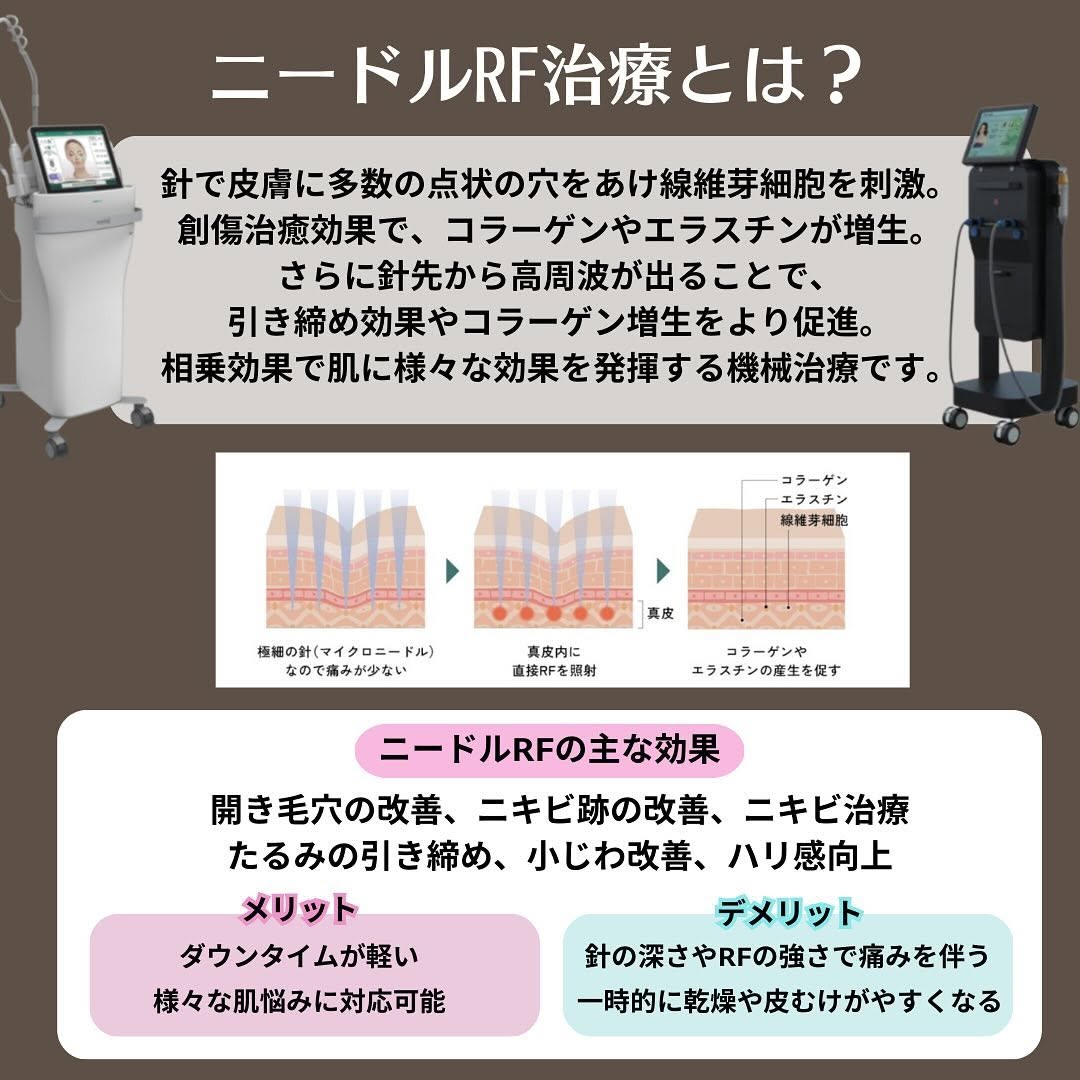 ポテンツァとサーマニードルの違い｜マイクロニードルRF2機種の特徴・適応・選び方を比較 画像2