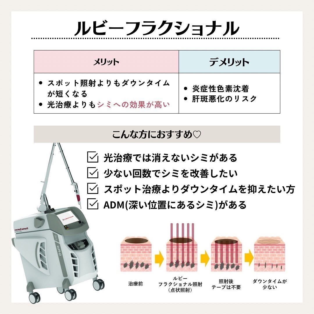 シミ治療の選び方｜ルビーフラクショナルとIPL（セレックV）の違いを徹底比較 画像3
