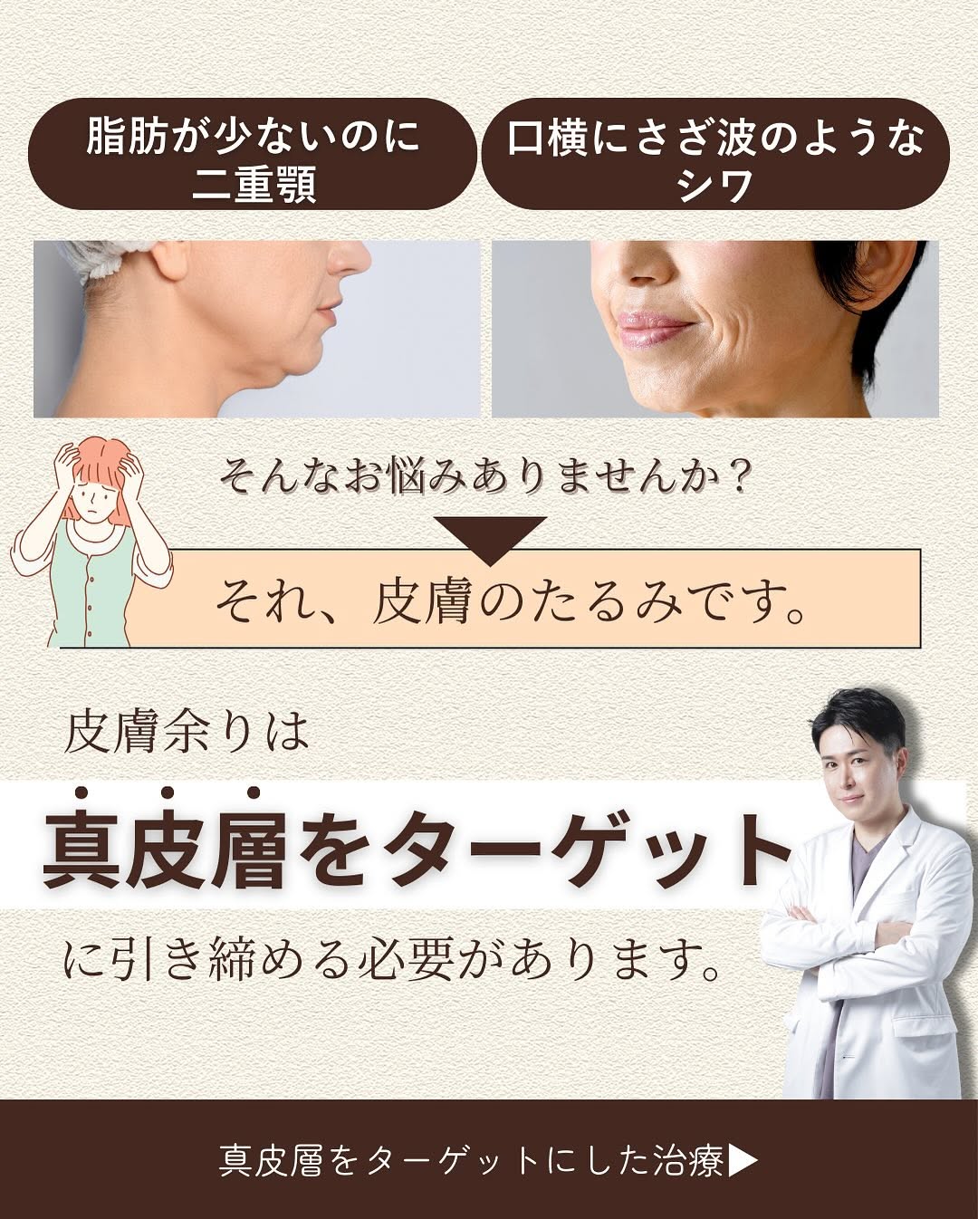 皮膚たるみに特化した治療3選｜ソフウェーブ・ショートスレッド・ニードルRFで真皮層から引き締め 画像2