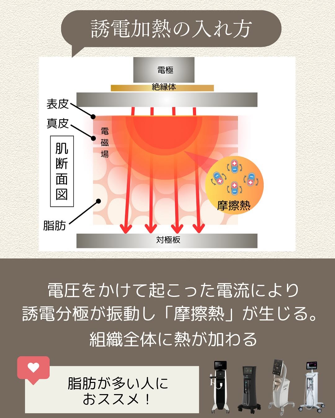 RF（ラジオ波）の加熱原理2種類｜ジュール熱と誘電加熱の違いと自分に合う機器の選び方 画像4