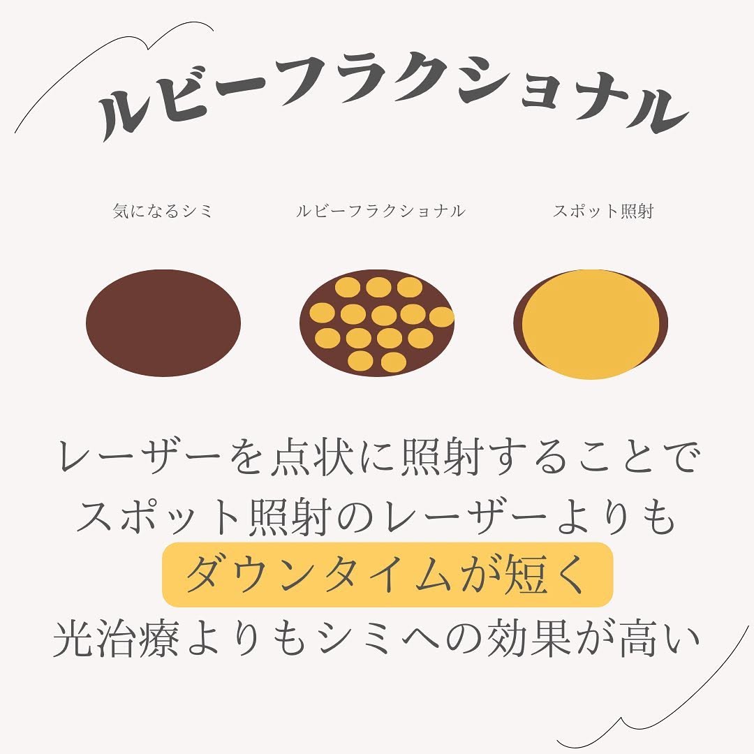 ルビーフラクショナルとは｜光治療で消えないシミ・ADMをダウンタイム短めで改善 画像2