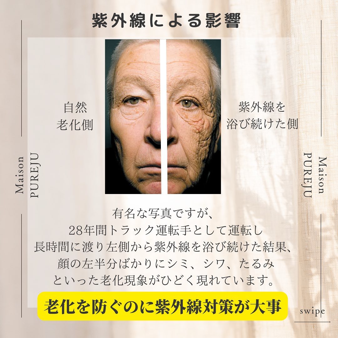 シミだけじゃない！紫外線が引き起こすシワ・たるみと光老化の正体 画像2