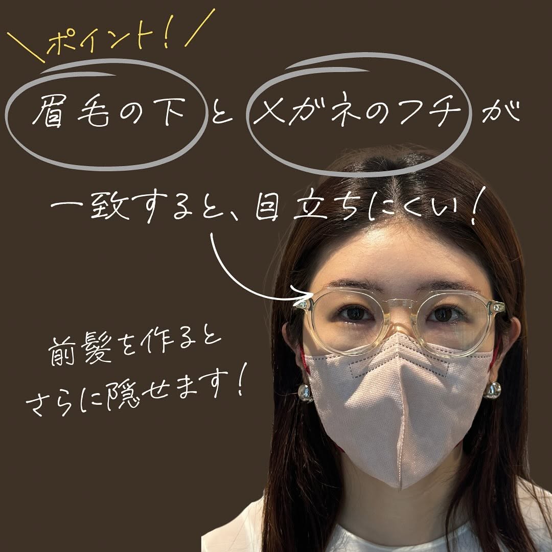 眉下切開のダウンタイム中にメガネで傷跡を目立たなくする方法を紹介した症例 画像2