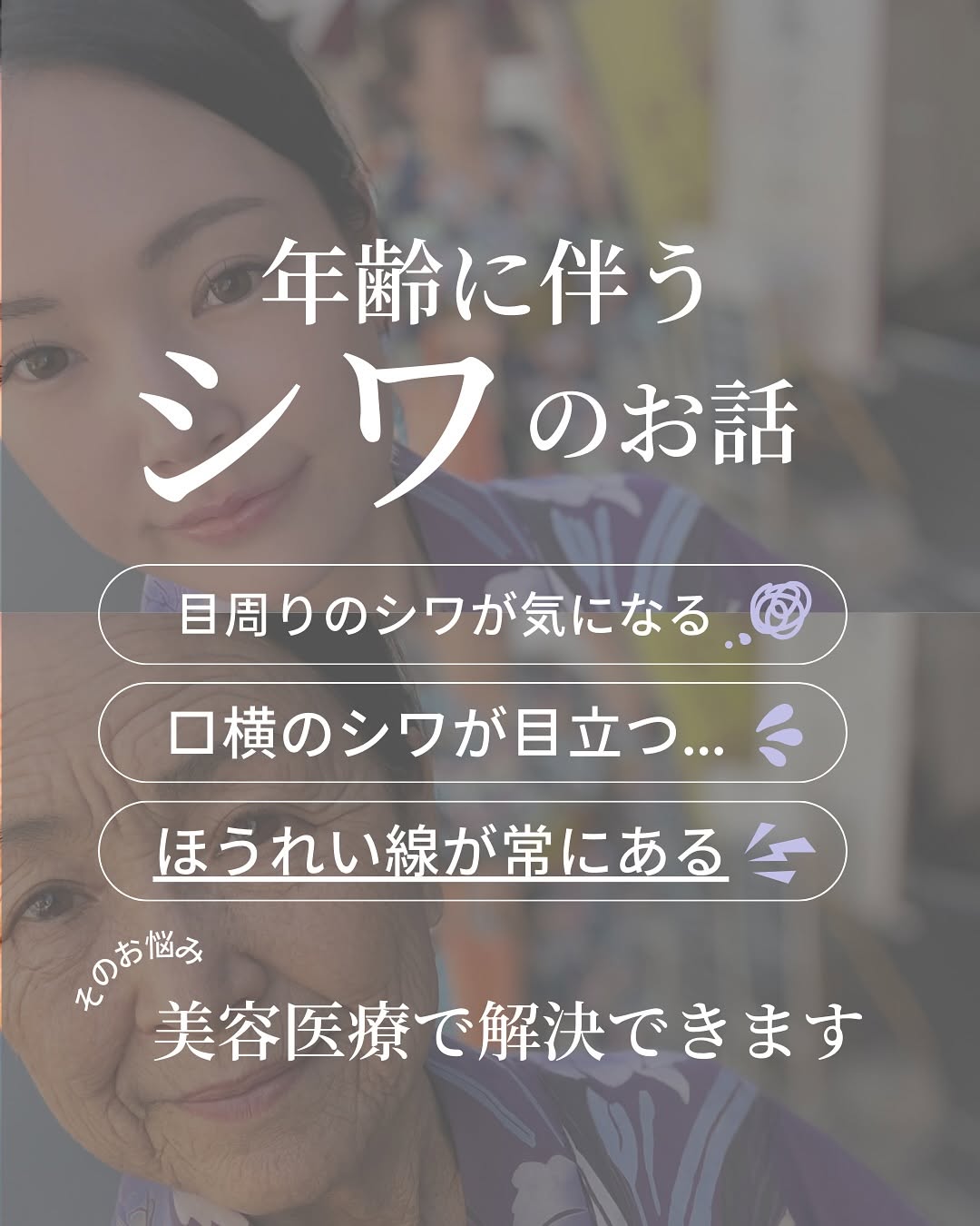 年齢に伴うシワのお話｜種類を知れば最適なケアが見えてくる