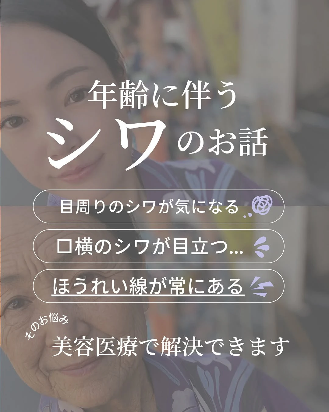年齢に伴うシワのお話|種類を知れば最適なケアが見えてくる