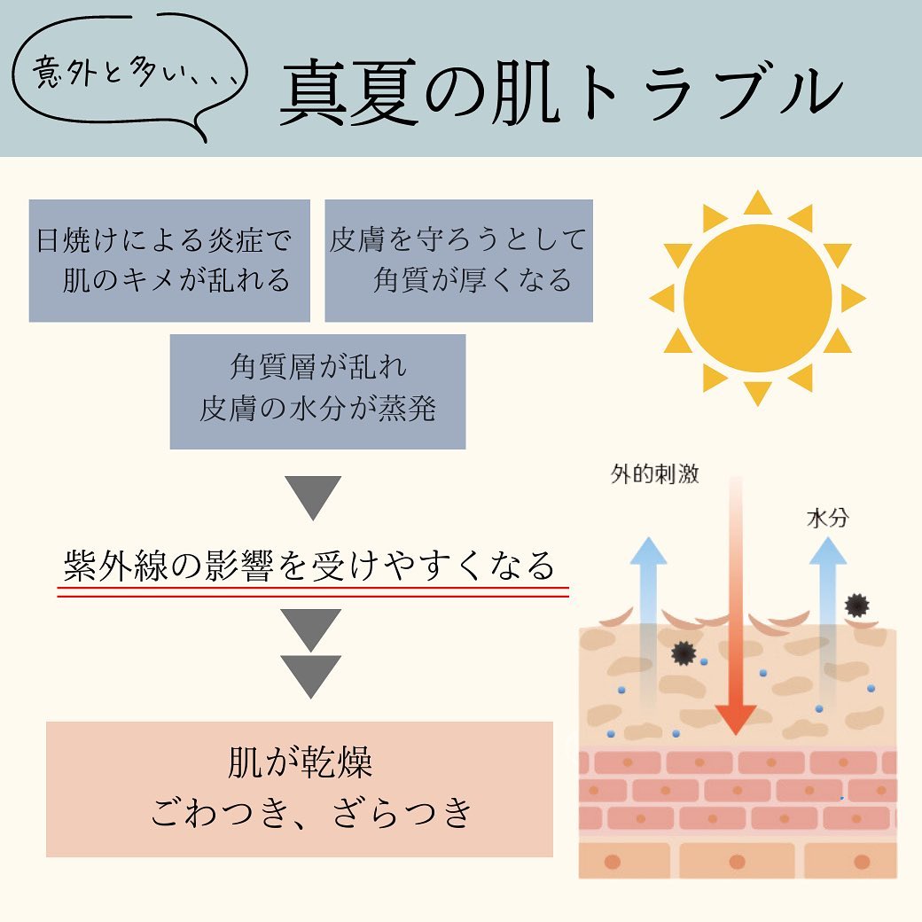 夏の紫外線ダメージを回復させる美容医療3選｜ペパーミントピール・メソナJ・高濃度VC点滴 画像2