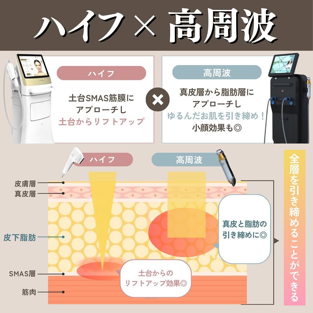 ハイフ×高周波（サーマZI）を組み合わせるメリット｜全層に熱を加える立体たるみ治療 画像3