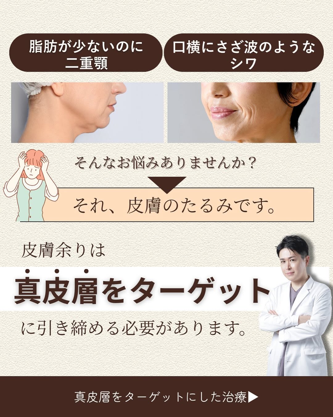 ソフウェーブであご下フェイスラインの皮膚のたるみをピタッと引き締めた症例 画像2