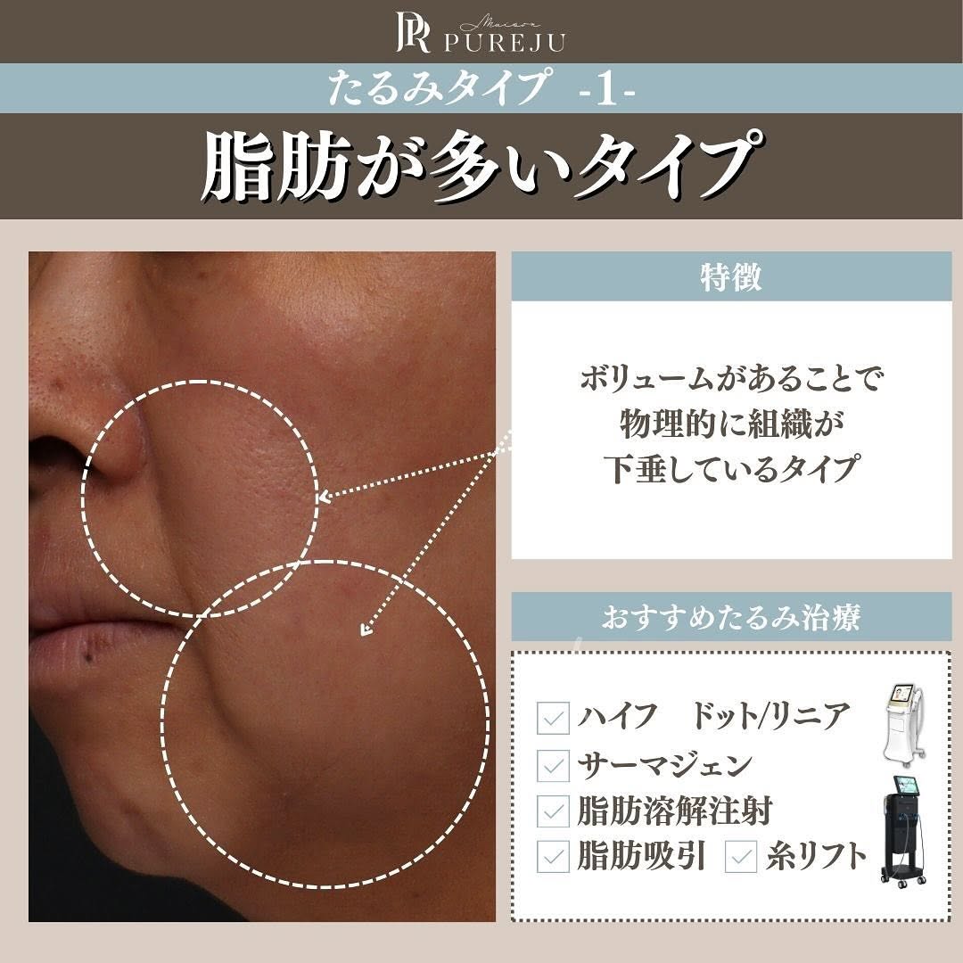 あなたのたるみはどのタイプ？原因3タイプ別おすすめ治療を医師が解説 画像3