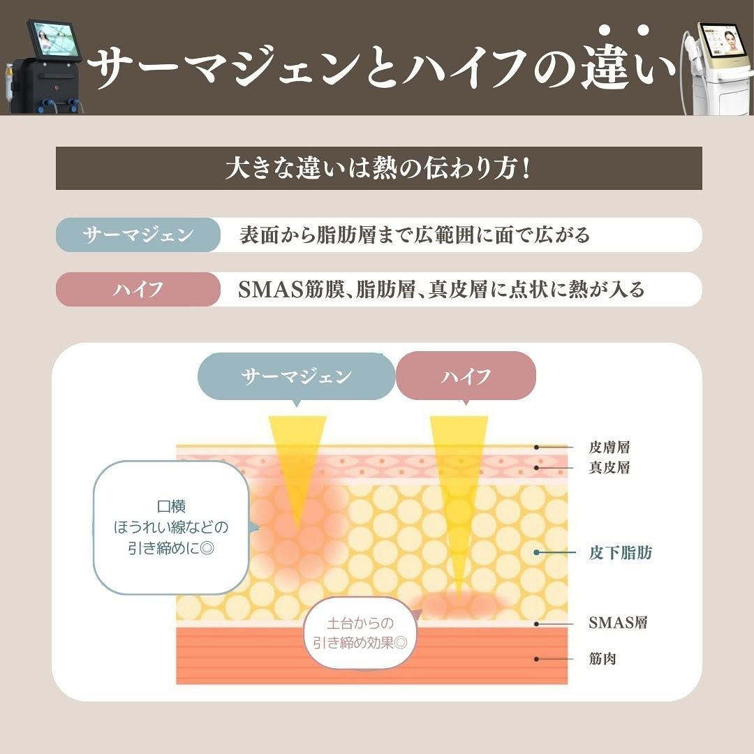 サーマジェン（高周波）の2段階効果とHIFUとの違い｜当院リピート率No.1のたるみ治療 画像3