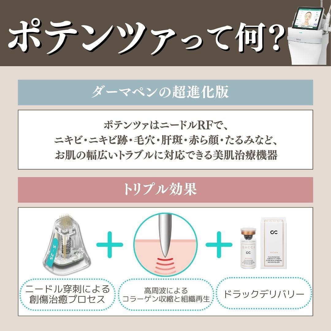 ポテンツァとは｜ニードル×RF×薬剤導入のトリプル効果で毛穴・ニキビ跡・肝斑を改善 画像2