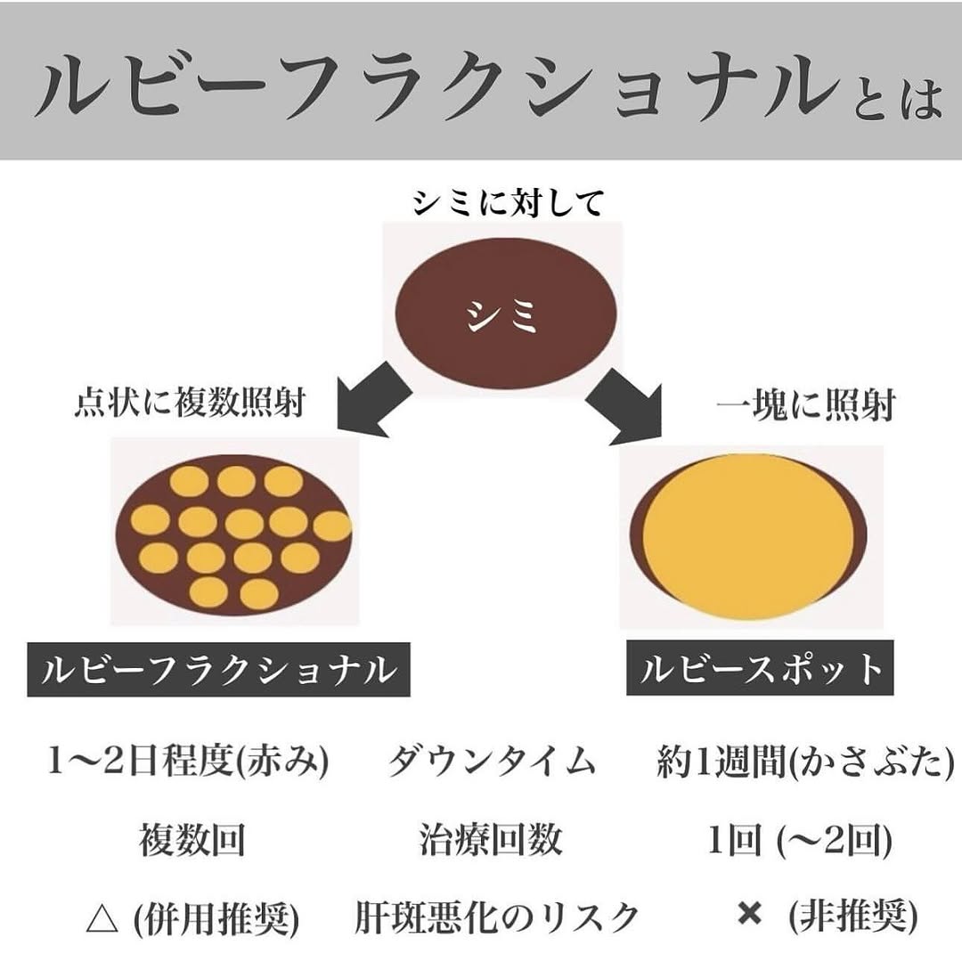 ルビーフラクショナルレーザーで細かいシミとそばかすを改善した症例 画像2