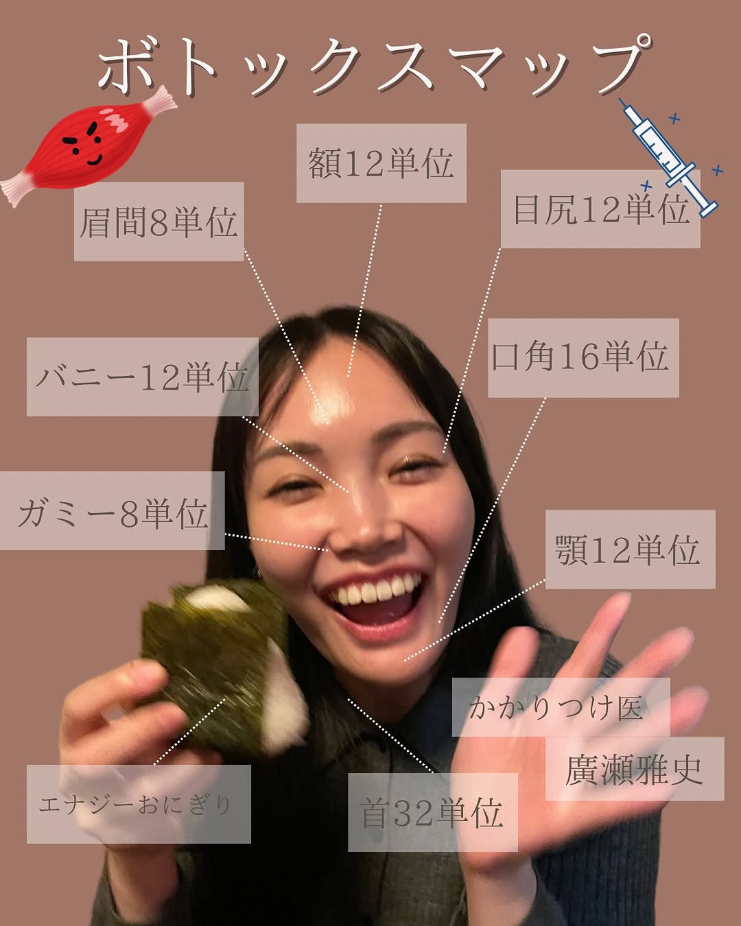 ボトックスは基本のキ！印象の良い表情をつくるための私のボトックスマップ