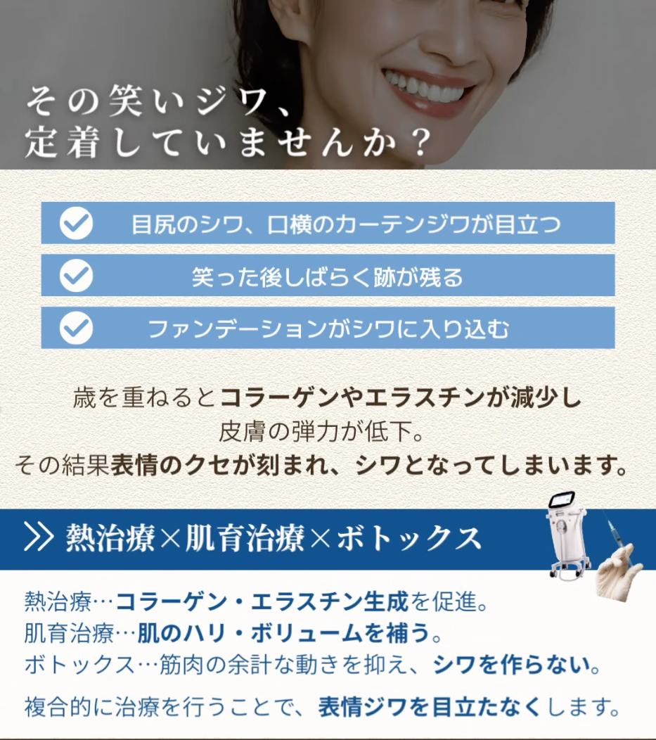 ソフウェーブ×バイオスカルプチャー×ボトックスの複合治療で笑った時の深い表情ジワを改善した症例（1ヶ月後）  画像2