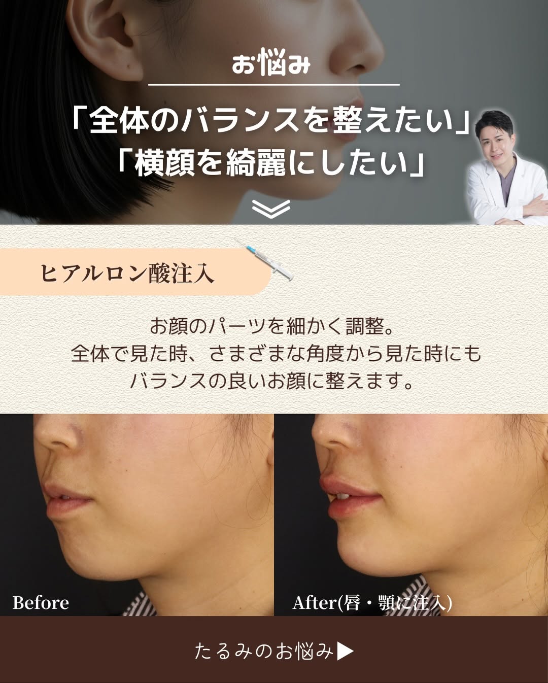 お悩み別おすすめ施術4選｜バランス・たるみ予防・皮だるみ・ツヤ肌それぞれに最適な治療とは 画像2