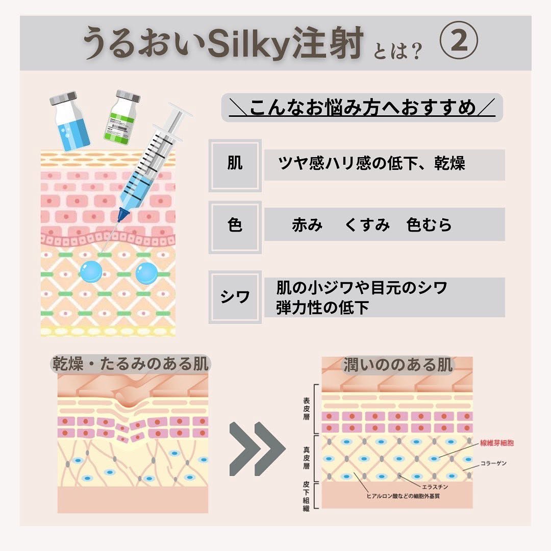 うるおいSilky注射とは｜数十種類の美容有効成分を直接注入する当院オリジナルスキンブースター 画像3