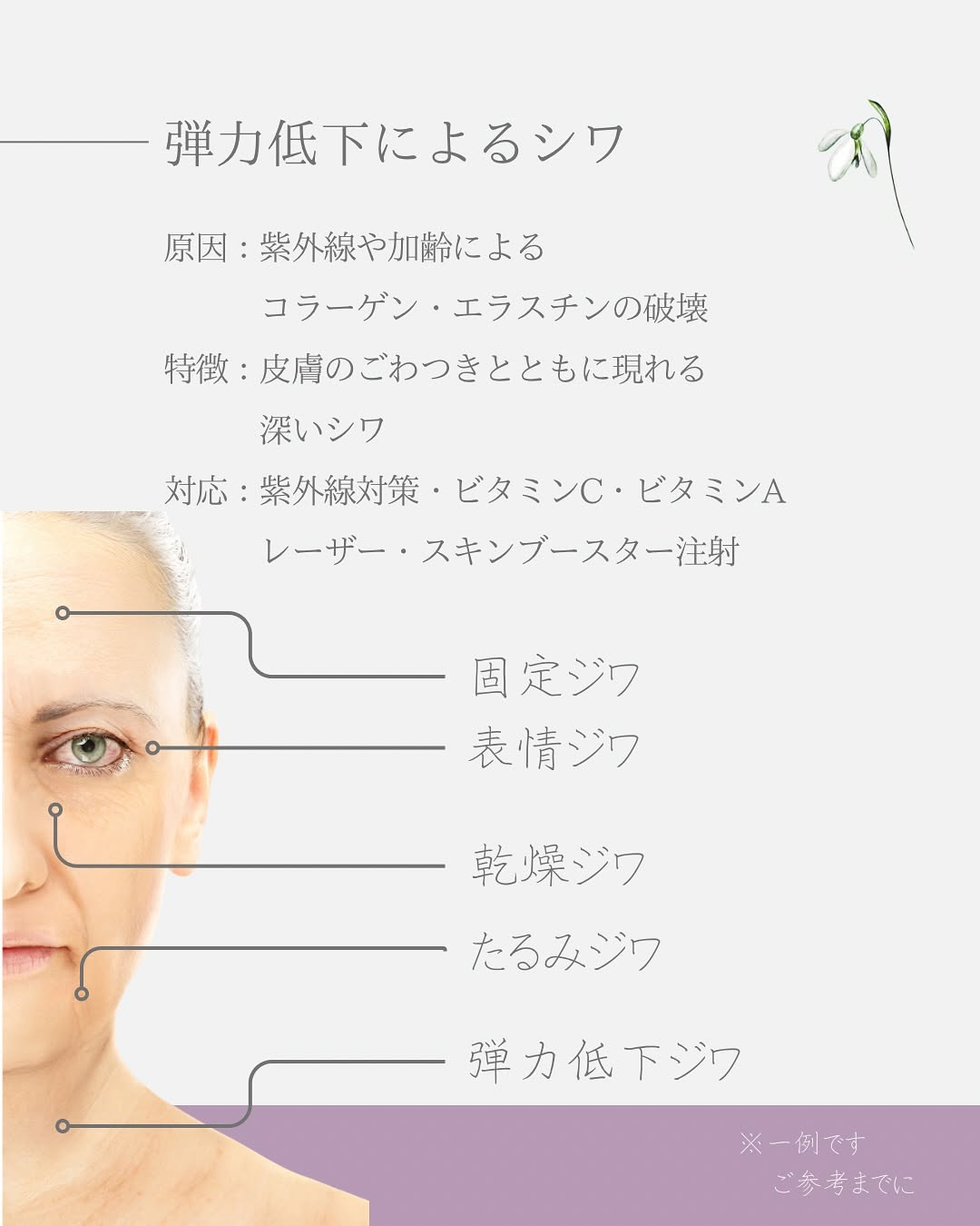 年齢に伴うシワのお話｜種類を知れば最適なケアが見えてくる 画像5