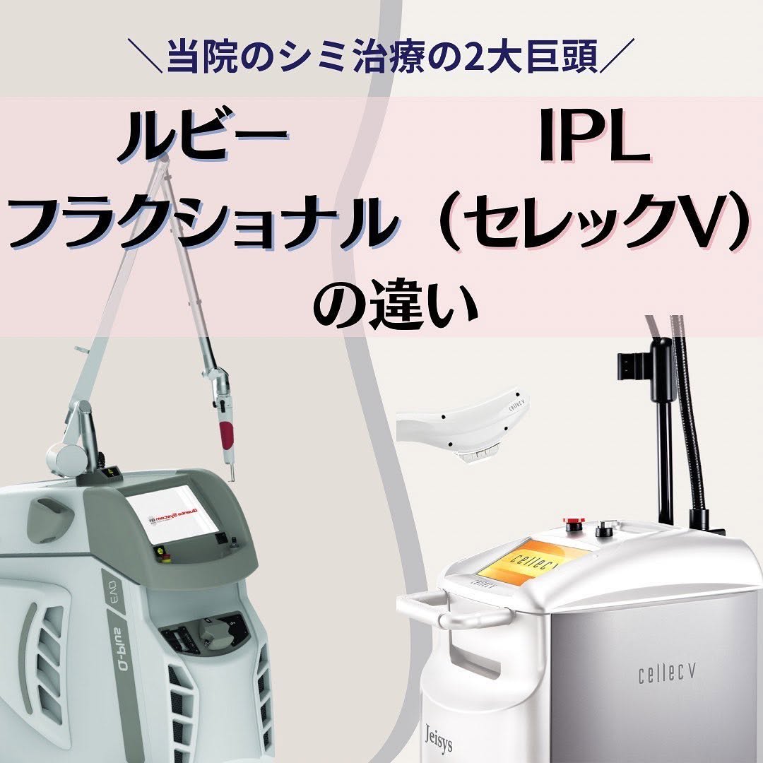 シミ治療の選び方｜ルビーフラクショナルとIPL（セレックV）の違いを徹底比較