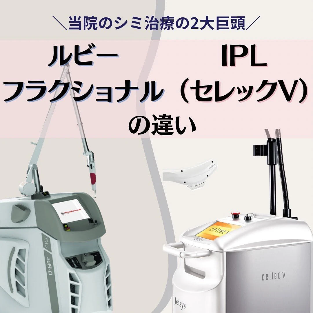 シミ治療の選び方|ルビーフラクショナルとIPL(セレックV)の違いを徹底比較