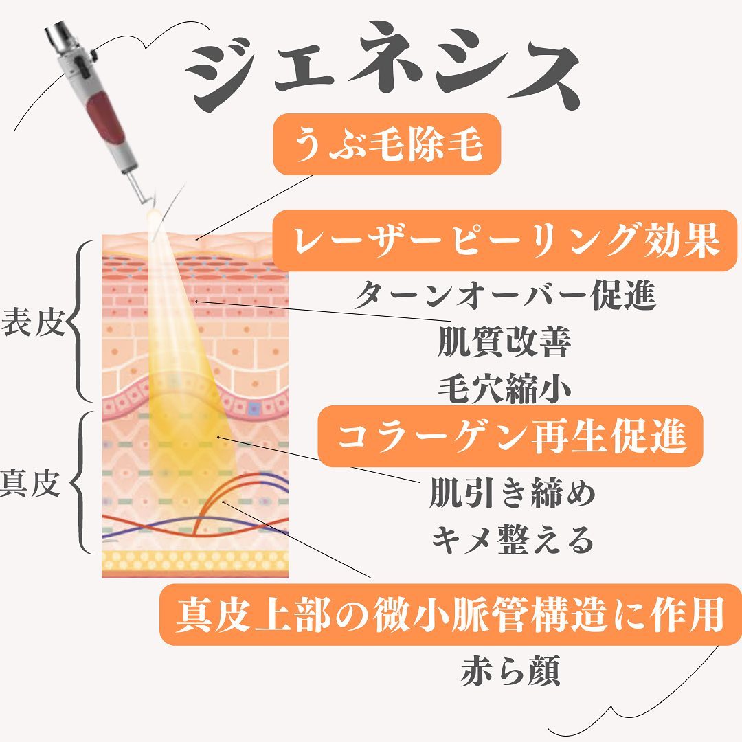 ジェネシスとは｜ロングパルスYAGレーザーで毛穴・赤ら顔・くすみをオールシーズン改善 画像2