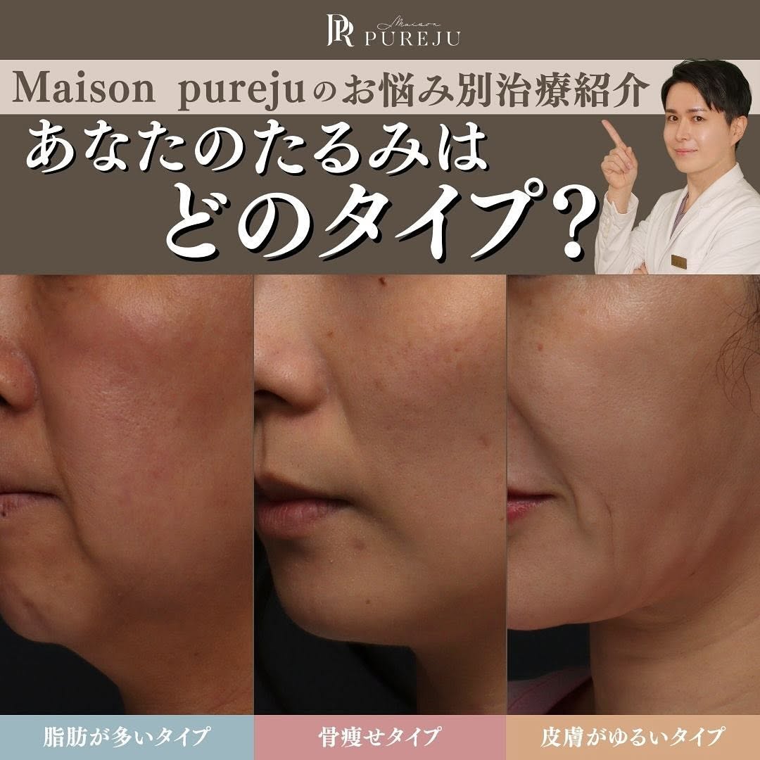 あなたのたるみはどのタイプ？原因3タイプ別おすすめ治療を医師が解説
