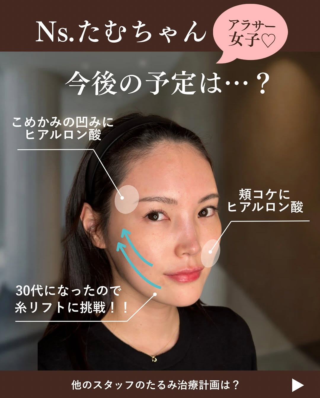 スタッフのたるみ治療年間計画｜アラサー・アラフォー看護師のリアルな施術スケジュール 画像3