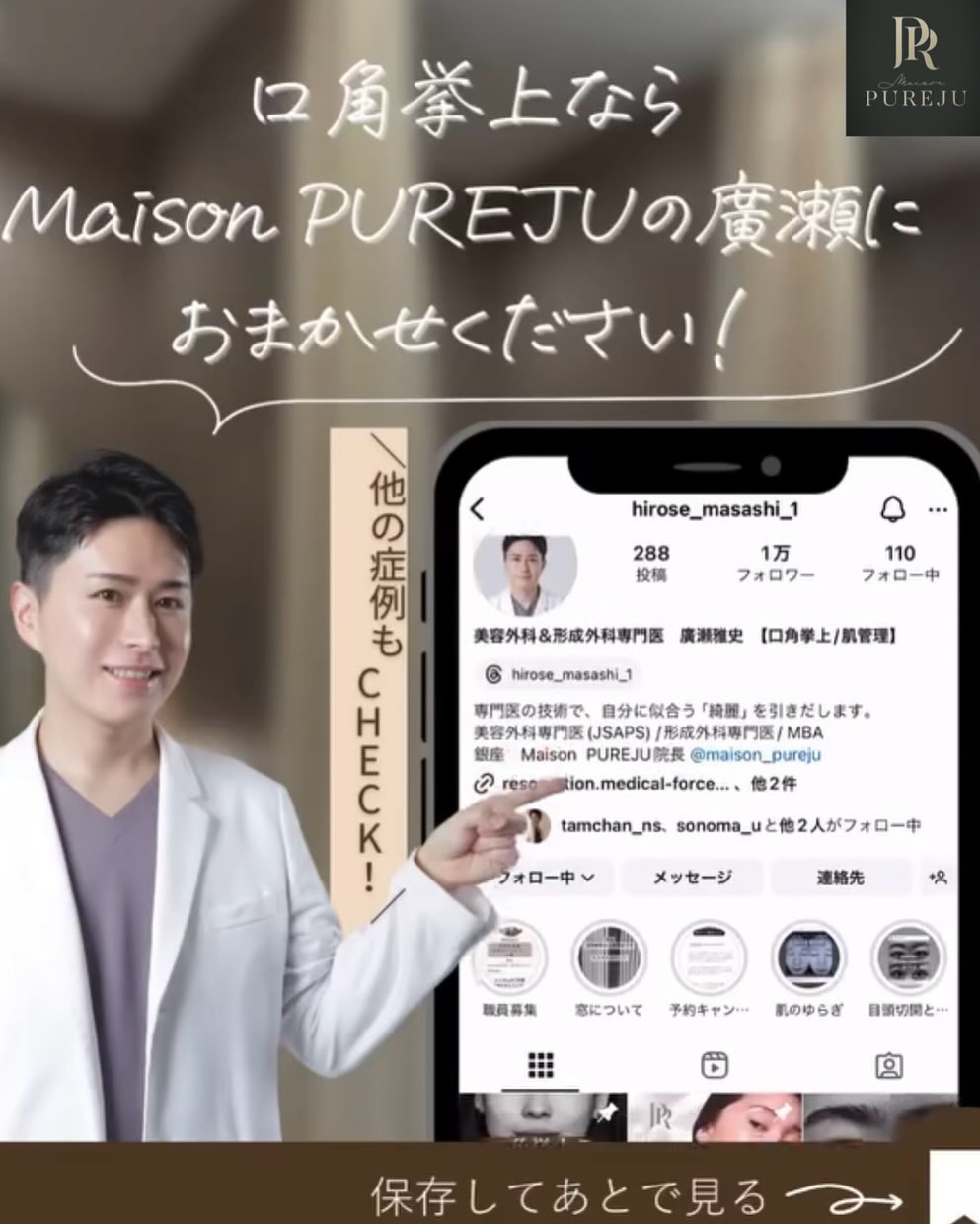 口角挙上術後1年の長期経過で笑いやすさ・しゃべりやすさも維持している症例 画像4