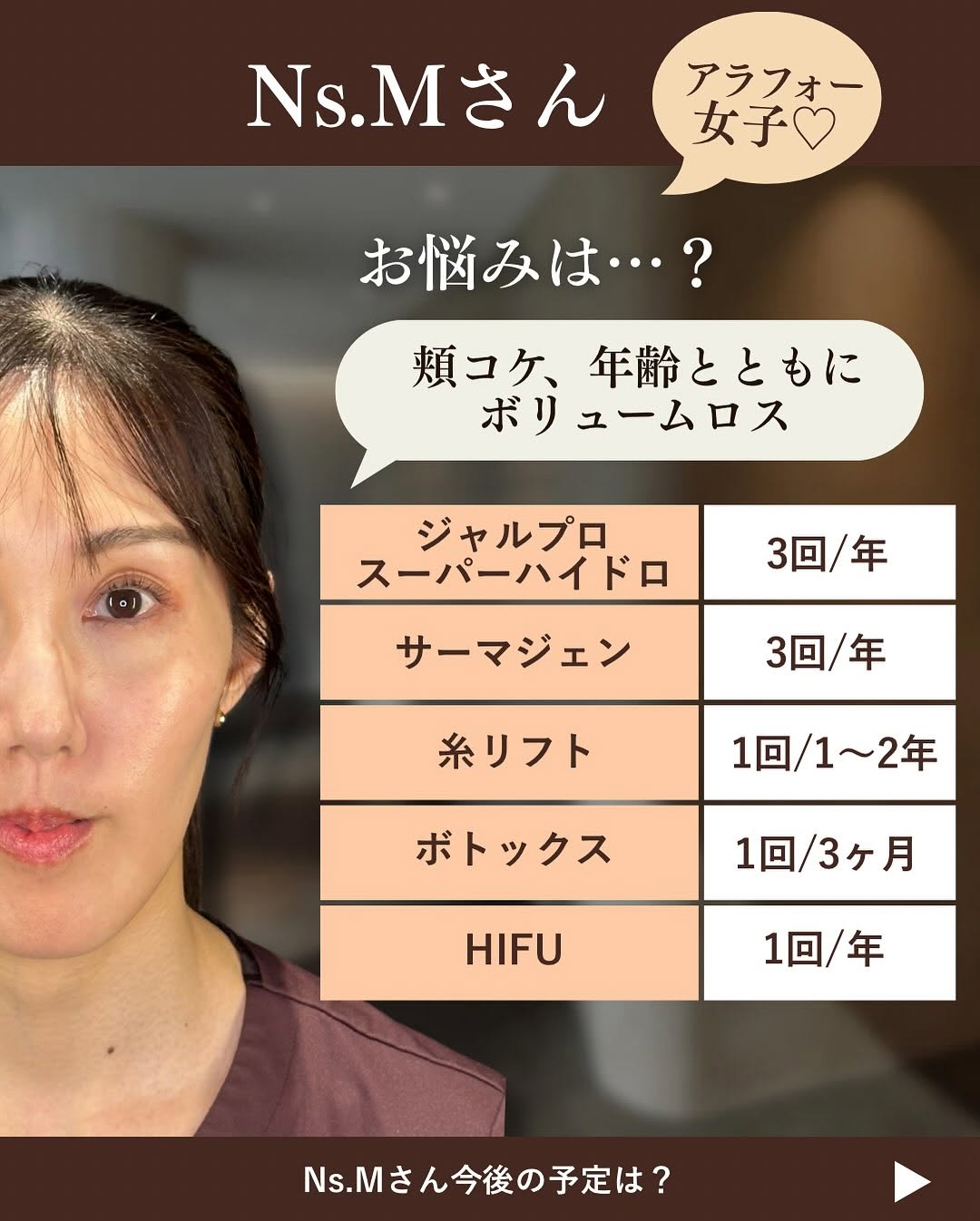 スタッフのたるみ治療年間計画｜アラサー・アラフォー看護師のリアルな施術スケジュール 画像4