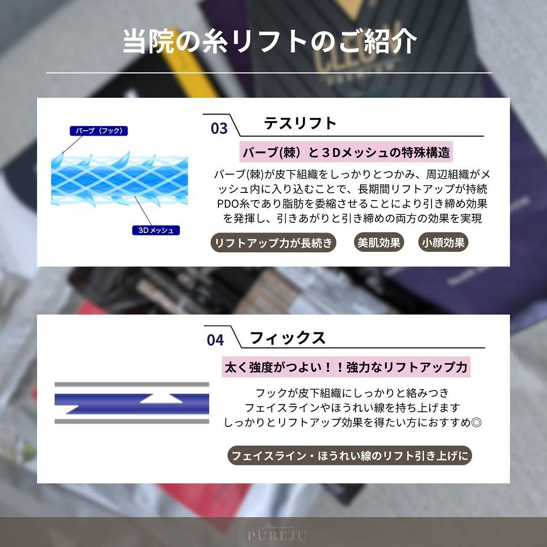 糸リフト7種類を徹底解説②｜スパイラル・ロイヤル・テスリフト・ミントリフトなど各糸の特徴と使い分け 画像3
