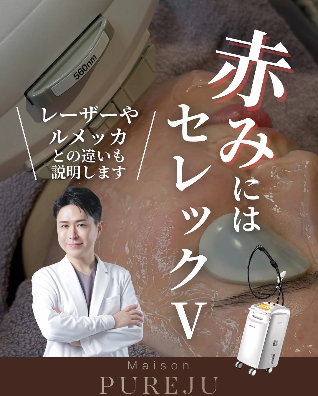 顔の赤みにはセレックV｜9種類のフィルターで赤み・シミ・くすみ・毛穴をオーダーメイドで改善するIPL治療