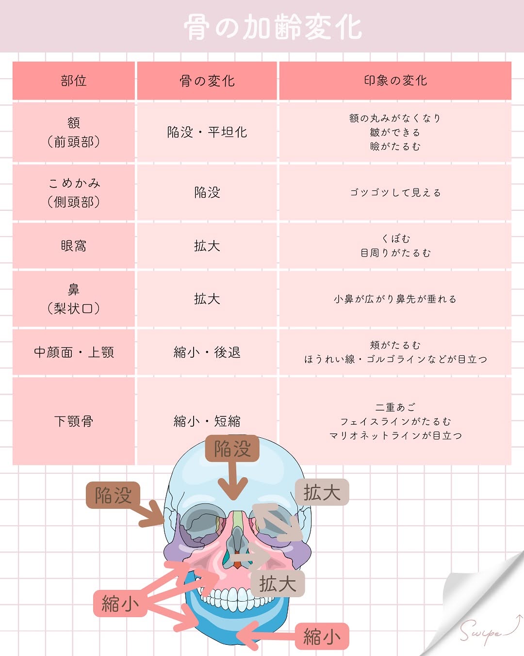 たるみの原因は骨にもあった！骨萎縮とエイジングの深い関係 画像3