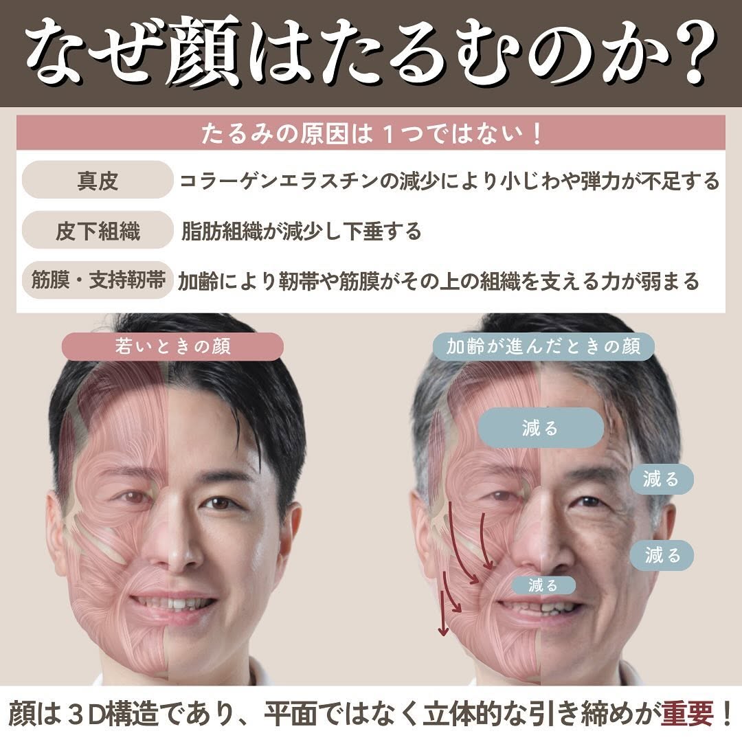 ハイフ×高周波（サーマZI）を組み合わせるメリット｜全層に熱を加える立体たるみ治療 画像2