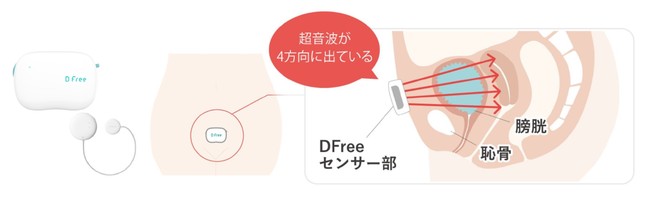 排泄予測デバイス『DFree』のクラウド自動連携を実現