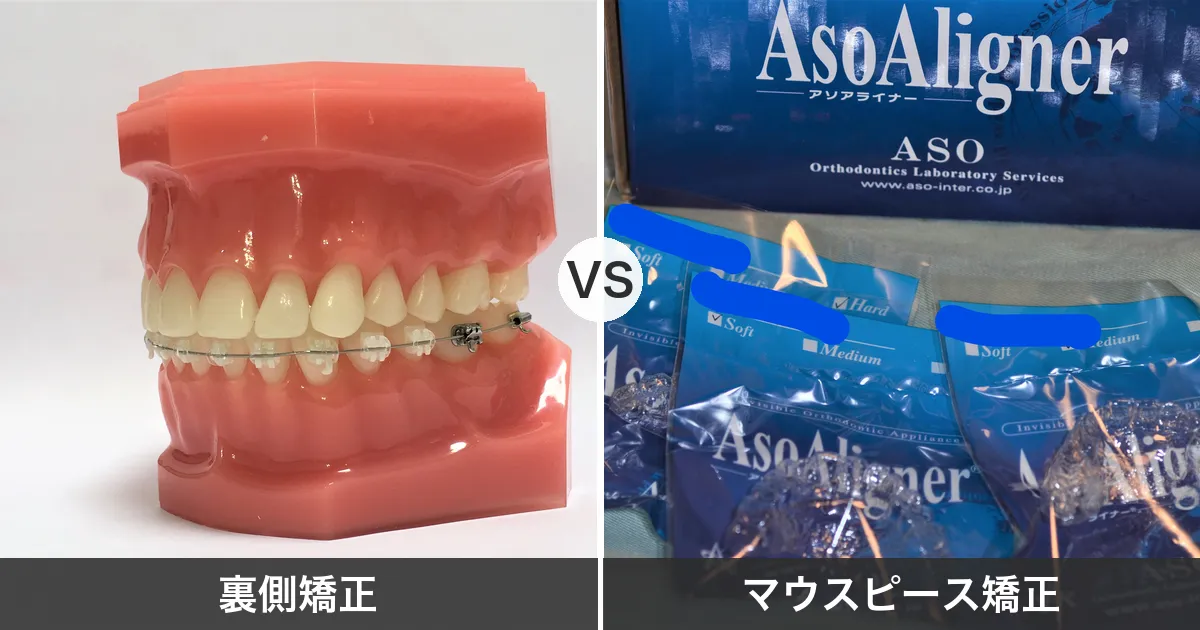 裏側矯正とマウスピース矯正の比較