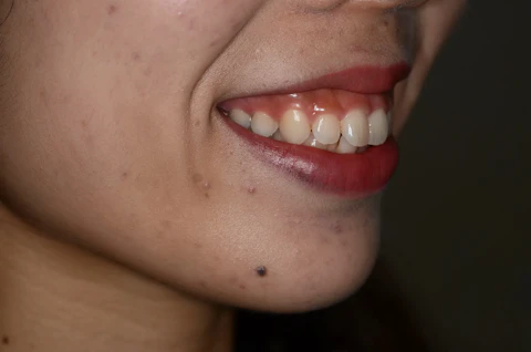 治療経過