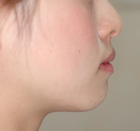 装置を装着した状態