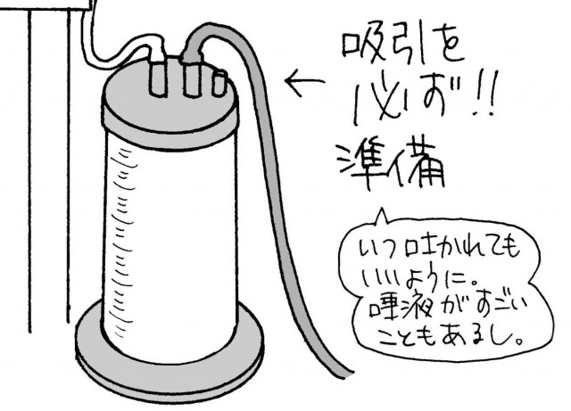 気管挿管に必要な吸引