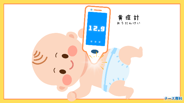 新生児高ビリルビン血症の補足資料