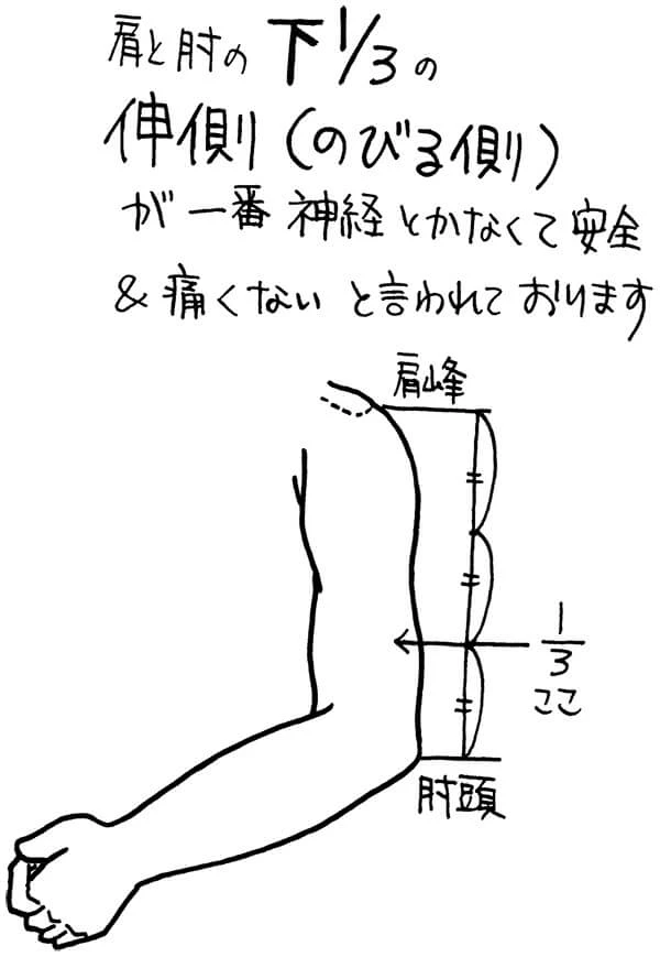 皮下注射の穿刺部位決定