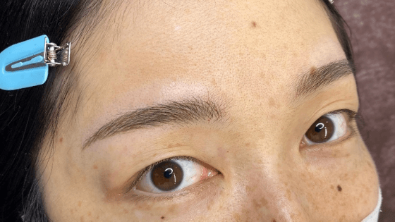 Before→After(斜め)