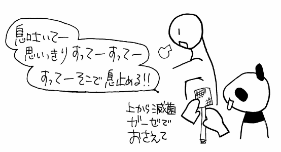 胸腔ドレーンの抜去手順 息を止めてもらう